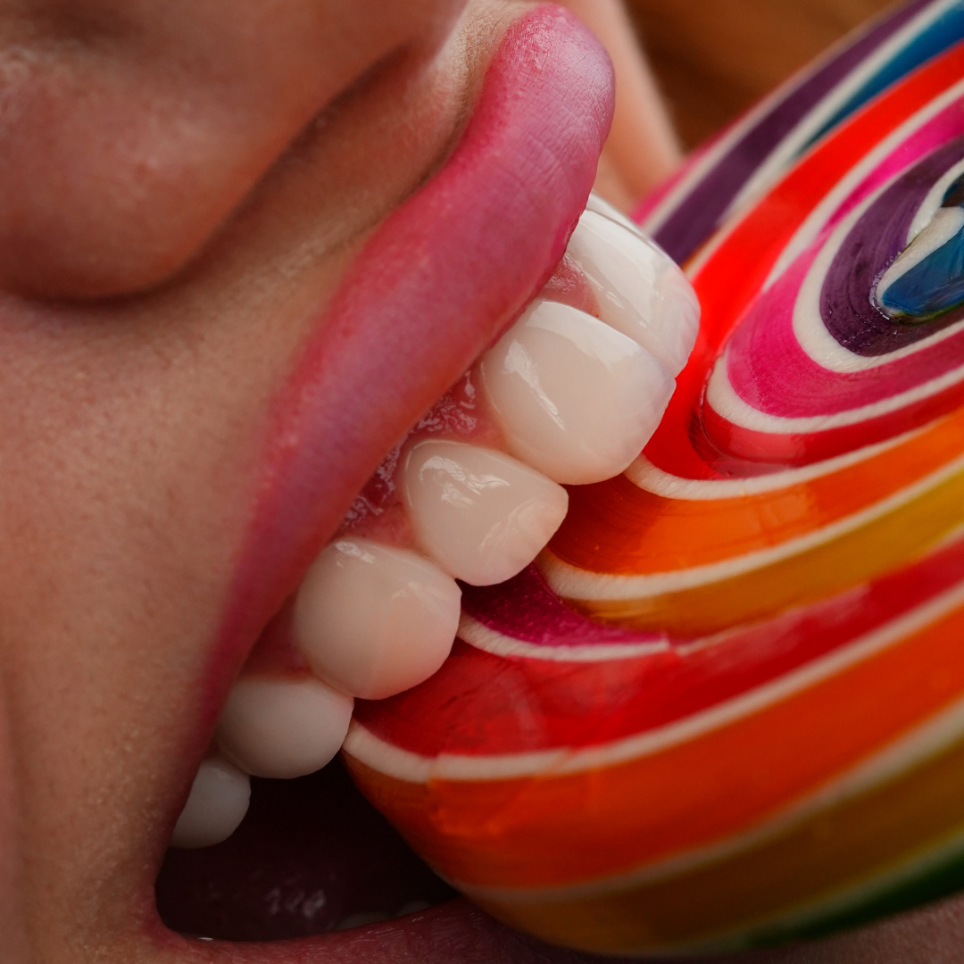 Smile Restoration Result