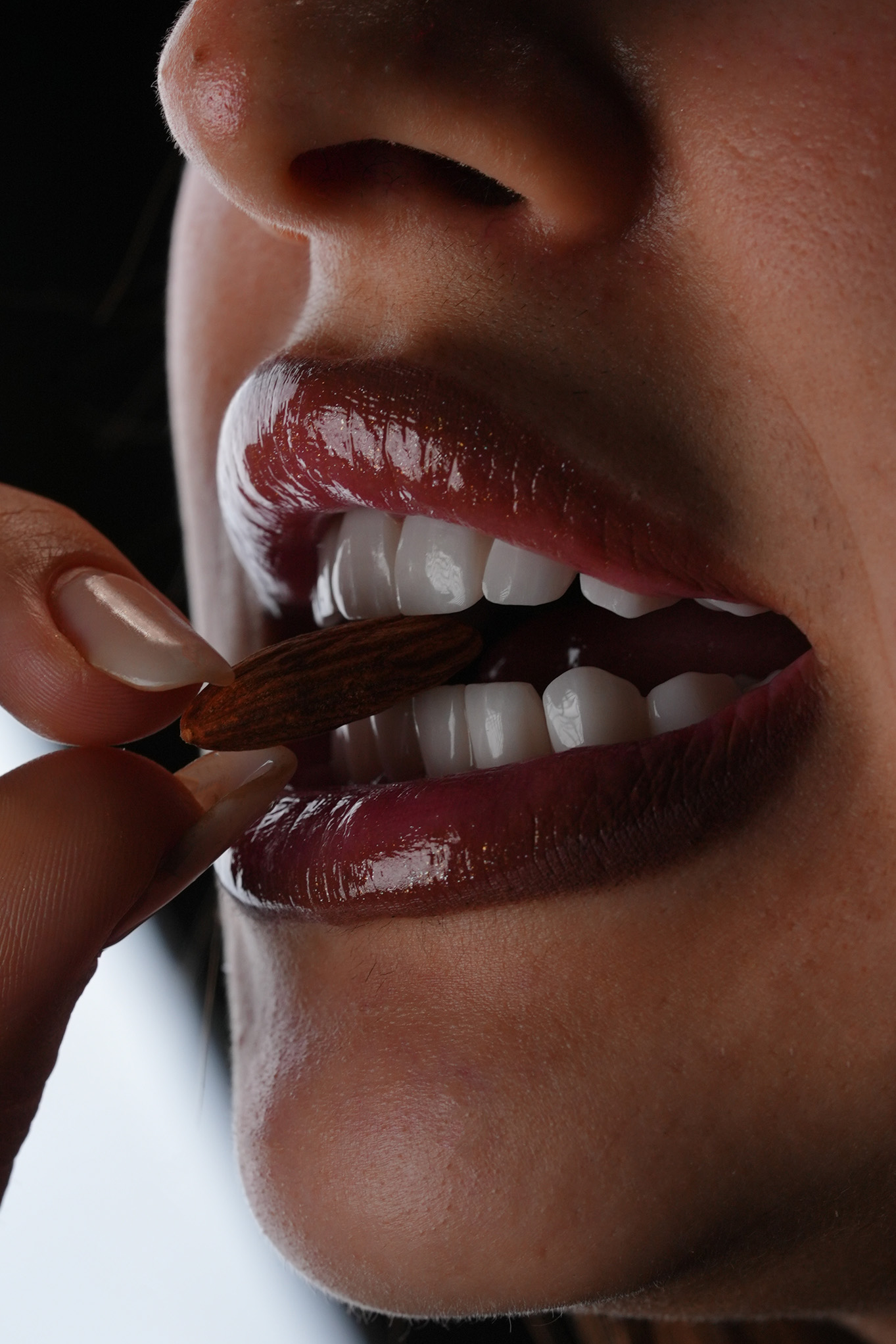 Smile Restoration Result